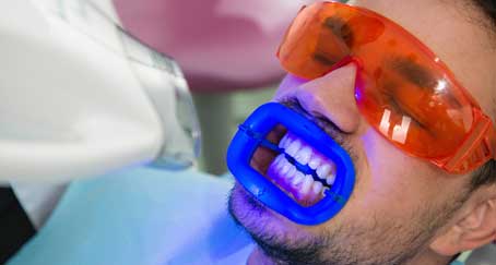laser teeth whitening is bad for your teeths health